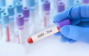 抗繆勒管激素（AMH）-磁微?；瘜W(xué)發(fā)光法（AE/AP） +熒光免疫層析解決方案