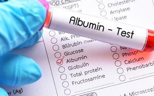 白蛋白（ALB）檢測(cè)試劑盒用原輔料