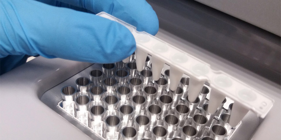 銅藍(lán)蛋白檢測(cè)