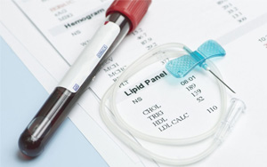 總膽固醇（TC）檢測試劑盒用原輔料