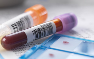 α2-巨球蛋白檢測試劑盒用原輔料