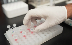 阿爾茲海默癥早期診斷標志物