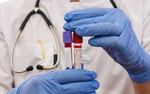 肌酸激酶同工酶（CK-MB）-磁微?；瘜W(xué)法學(xué)發(fā)光（AE/AP） /熒光免疫層析解決方案