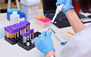 可溶性生長刺激表達(dá)基因2蛋白（ST2）- 磁微?；瘜W(xué)發(fā)光法（吖啶酯）/熒光免疫層析解決方案