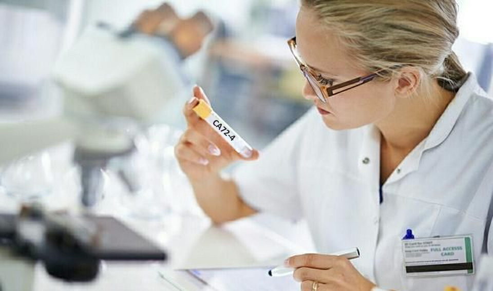 糖類抗原72-4（CA72-4）-磁微?；瘜W(xué)發(fā)光（吖啶酯）
解決方案